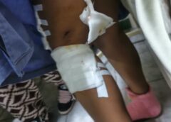 Sucre: Adolescente de 15 años es hospitalizada tras sufrir ataque de jauría de canes || La menor, salió al rescate de un gato. Los vecinos aseguran que son los mismos perros que quitaron la vida a un joven la semana anterior.